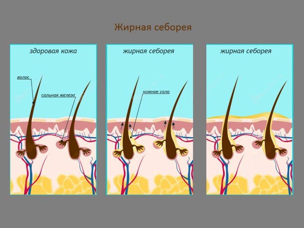 Депрессия у кошек: симптомы, диагностика, лечение