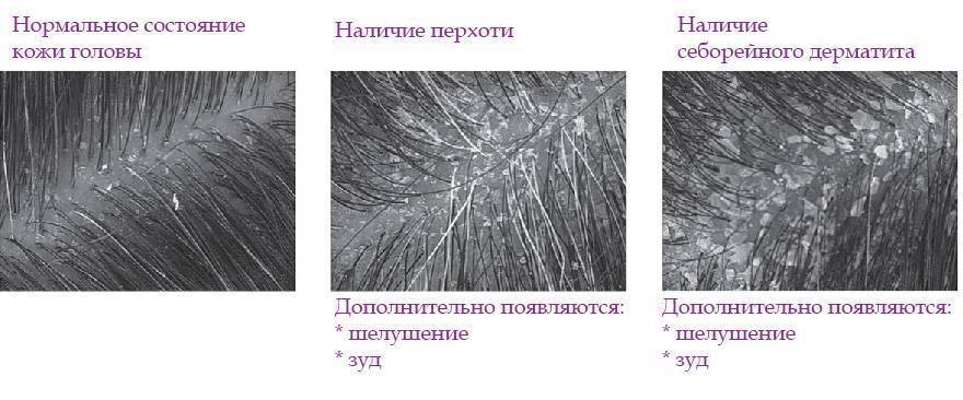 Бронхиальная астма кошек